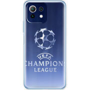 Чехол BoxFace Xiaomi Mi 11 Lite 