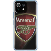 Чехол BoxFace Xiaomi Mi 11 Lite 