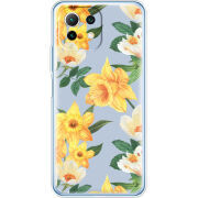 Чехол BoxFace Xiaomi Mi 11 Lite 