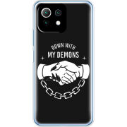 Чехол BoxFace Xiaomi Mi 11 Lite 