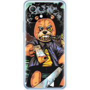 Чехол BoxFace Xiaomi Mi 11 Lite 