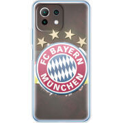 Чехол BoxFace Xiaomi Mi 11 Lite 