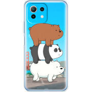 Чехол BoxFace Xiaomi Mi 11 Lite 