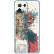 Чехол BoxFace Xiaomi Mi 11 Lite 