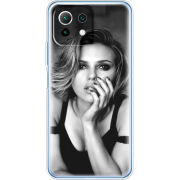 Чехол BoxFace Xiaomi Mi 11 Lite 