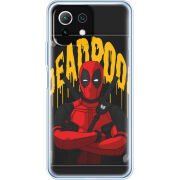 Чехол BoxFace Xiaomi Mi 11 Lite 