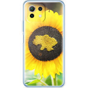 Чехол BoxFace Xiaomi Mi 11 Lite 