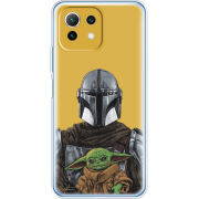 Чехол BoxFace Xiaomi Mi 11 Lite Маленький Йода