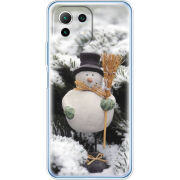 Чехол BoxFace Xiaomi Mi 11 Lite 