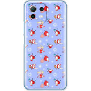 Чехол BoxFace Xiaomi Mi 11 Lite 