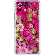 Чехол BoxFace Xiaomi Mi 11 Lite 