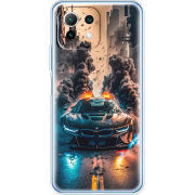 Чехол BoxFace Xiaomi Mi 11 Lite 