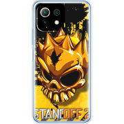 Чехол BoxFace Xiaomi Mi 11 Lite StandOff 2 gold