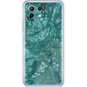 Чехол BoxFace Xiaomi Mi 11 Lite 