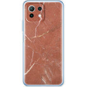 Чехол BoxFace Xiaomi Mi 11 Lite 