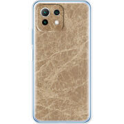 Чехол BoxFace Xiaomi Mi 11 Lite 