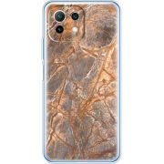 Чехол BoxFace Xiaomi Mi 11 Lite 