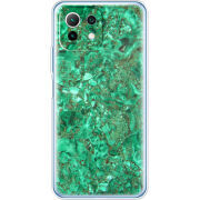 Чехол BoxFace Xiaomi Mi 11 Lite 