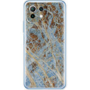 Чехол BoxFace Xiaomi Mi 11 Lite 