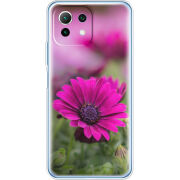 Чехол BoxFace Xiaomi Mi 11 Lite 