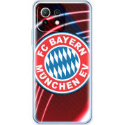 Чехол BoxFace Xiaomi Mi 11 Lite 