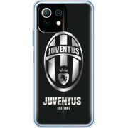 Чехол BoxFace Xiaomi Mi 11 Lite 