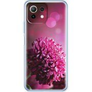 Чехол BoxFace Xiaomi Mi 11 Lite 