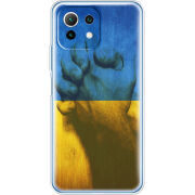 Чехол BoxFace Xiaomi Mi 11 Lite Handshake