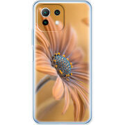 Чехол BoxFace Xiaomi Mi 11 Lite 