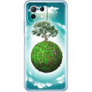 Чехол BoxFace Xiaomi Mi 11 Lite 