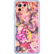 Чехол BoxFace Xiaomi Mi 11 Lite 