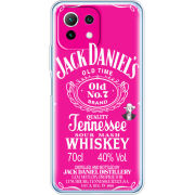 Чехол BoxFace Xiaomi Mi 11 Lite 