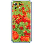 Чехол BoxFace Xiaomi Mi 11 Lite 