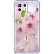 Чехол BoxFace Xiaomi Mi 11 Lite 