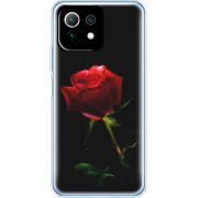 Чехол BoxFace Xiaomi Mi 11 Lite 