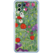 Чехол BoxFace Xiaomi Mi 11 Lite 