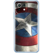 Чехол BoxFace Xiaomi Mi 11 Lite 