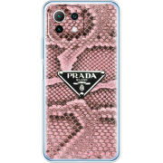 Чехол BoxFace Xiaomi Mi 11 Lite 