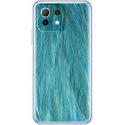 Чехол BoxFace Xiaomi Mi 11 Lite 