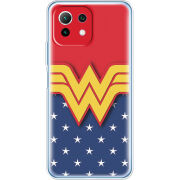 Чехол BoxFace Xiaomi Mi 11 Lite 