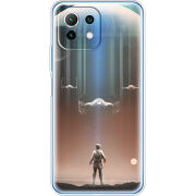 Чехол BoxFace Xiaomi Mi 11 Lite 