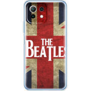 Чехол BoxFace Xiaomi Mi 11 Lite 