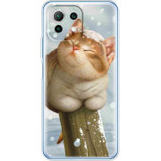 Чехол BoxFace Xiaomi Mi 11 Lite 