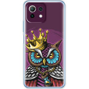 Чехол BoxFace Xiaomi Mi 11 Lite 