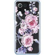 Чехол BoxFace Xiaomi Mi 11 Lite 