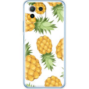 Чехол BoxFace Xiaomi Mi 11 Lite 