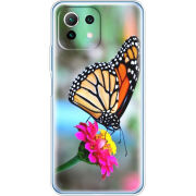 Чехол BoxFace Xiaomi Mi 11 Lite 