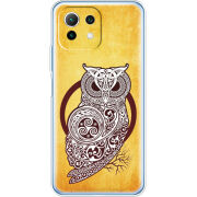 Чехол BoxFace Xiaomi Mi 11 Lite 