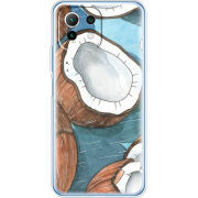 Чехол BoxFace Xiaomi Mi 11 Lite 