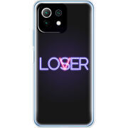 Чехол BoxFace Xiaomi Mi 11 Lite 